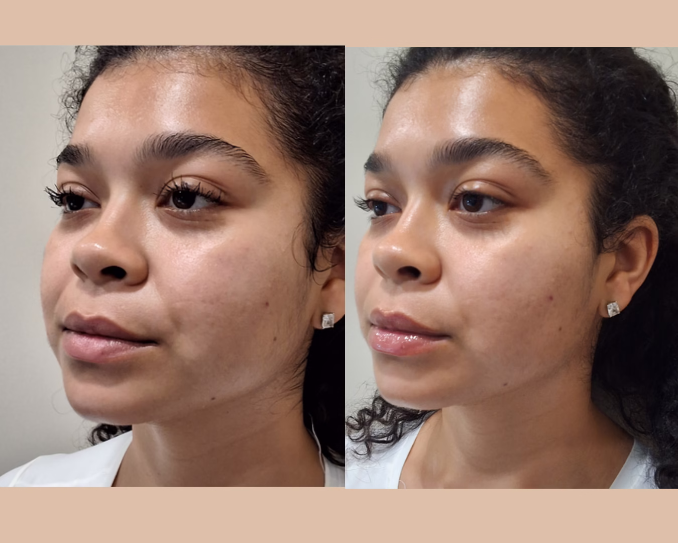 Sculpting facial before and after