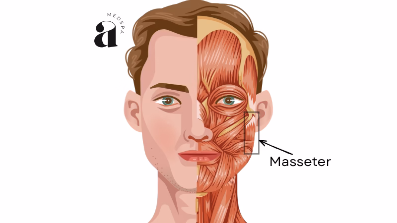 Best Masseter Botox in NJ: What to Know Before You Book 1 Diagram of facial anatomy highlighting the Masseter muscle, where masseter botox is injected.